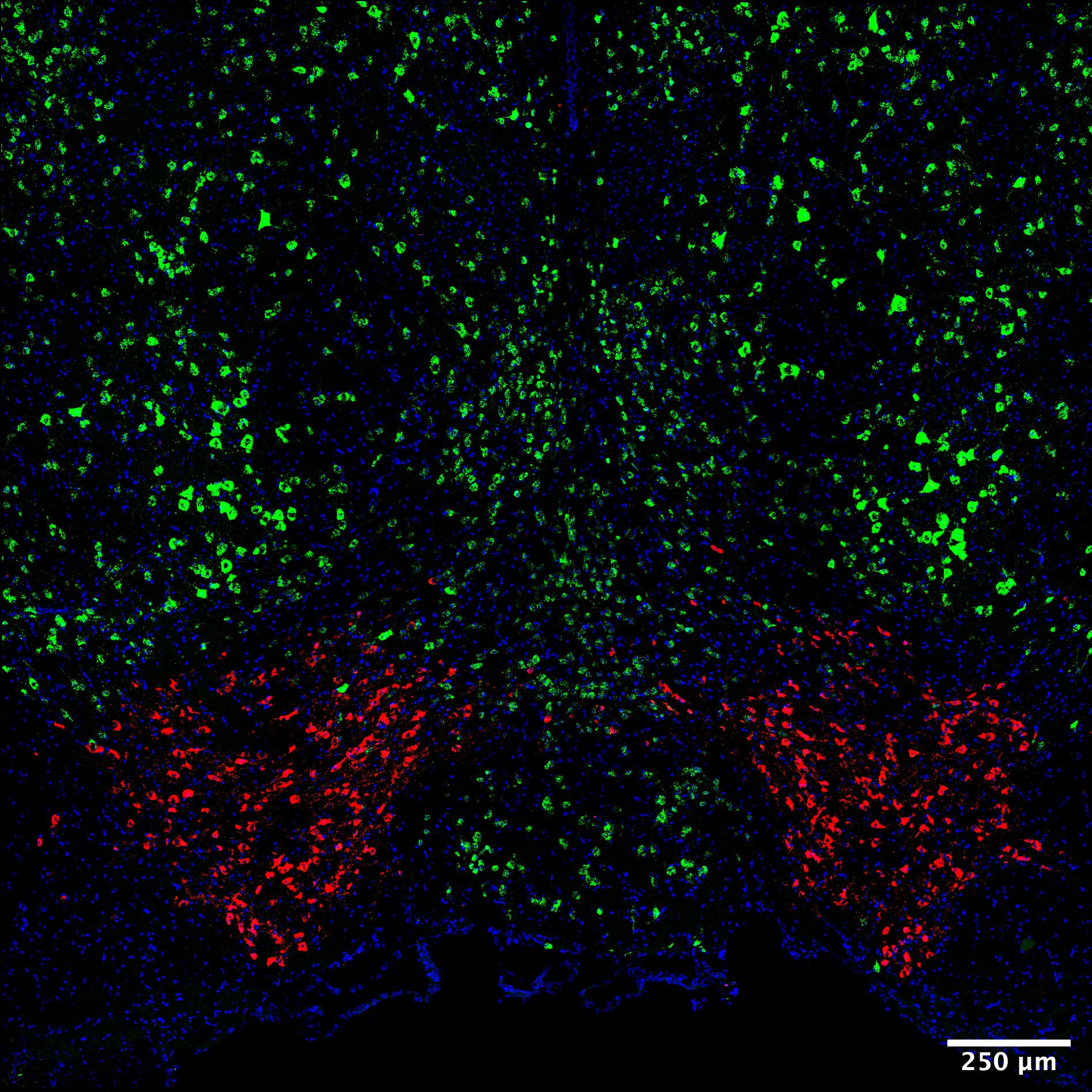 Brain fluorescent image 1