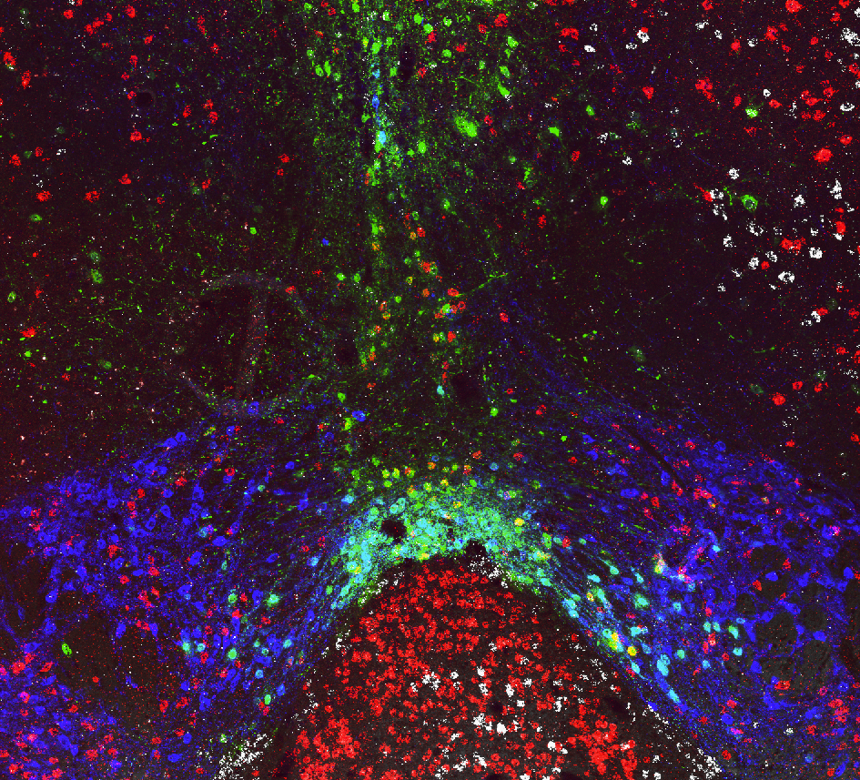 Fluorescent microscopy image